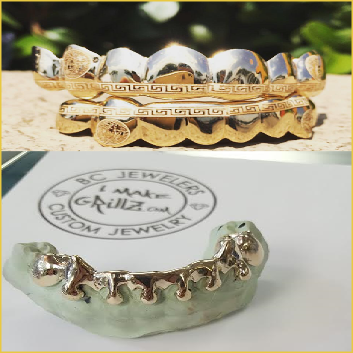 Engraving and Drip Grillz