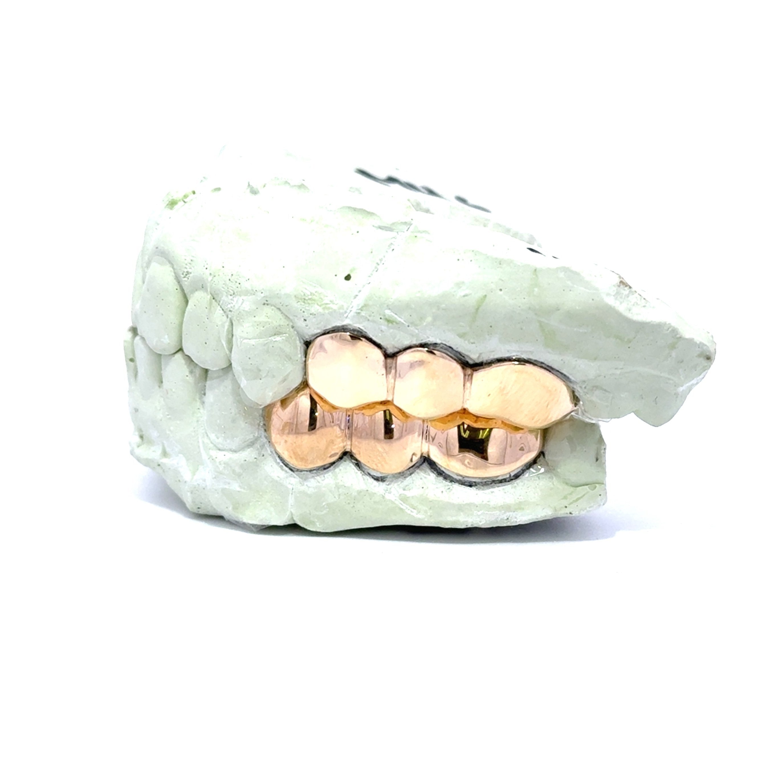 3 Piece Gold Grillz