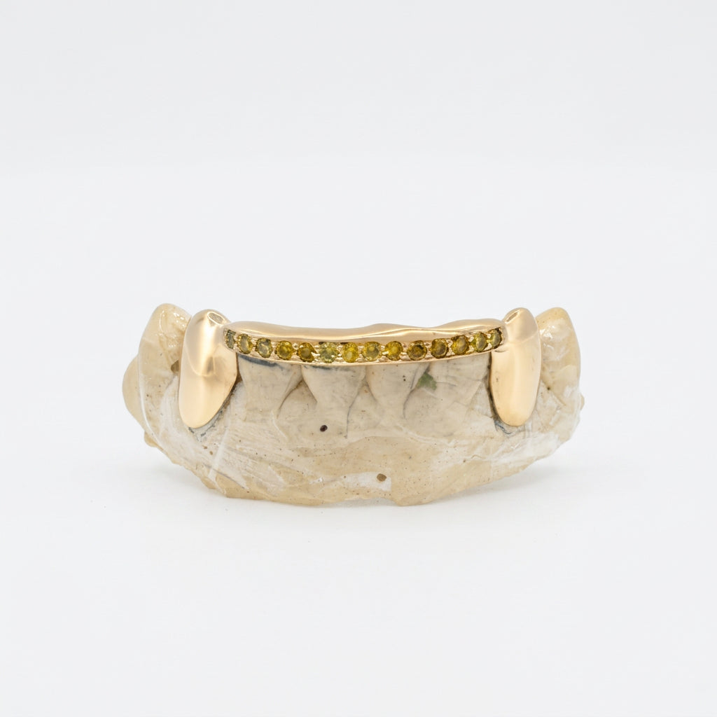 Natural Yellow Canary Diamond Bar Grillz (One Row)