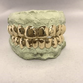 14K Gold Grill Special