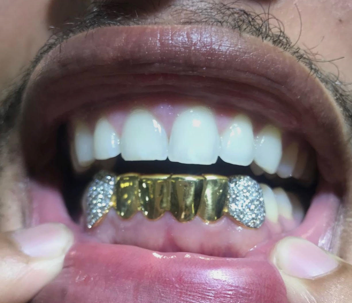 Bottom grillz diamond sales