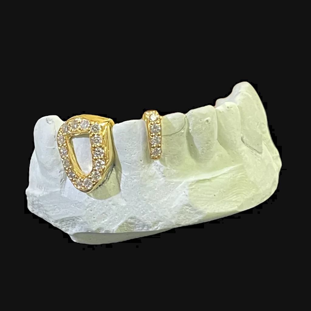 Custom Diamond Spacer Grill