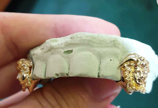 Medusa Head Grill