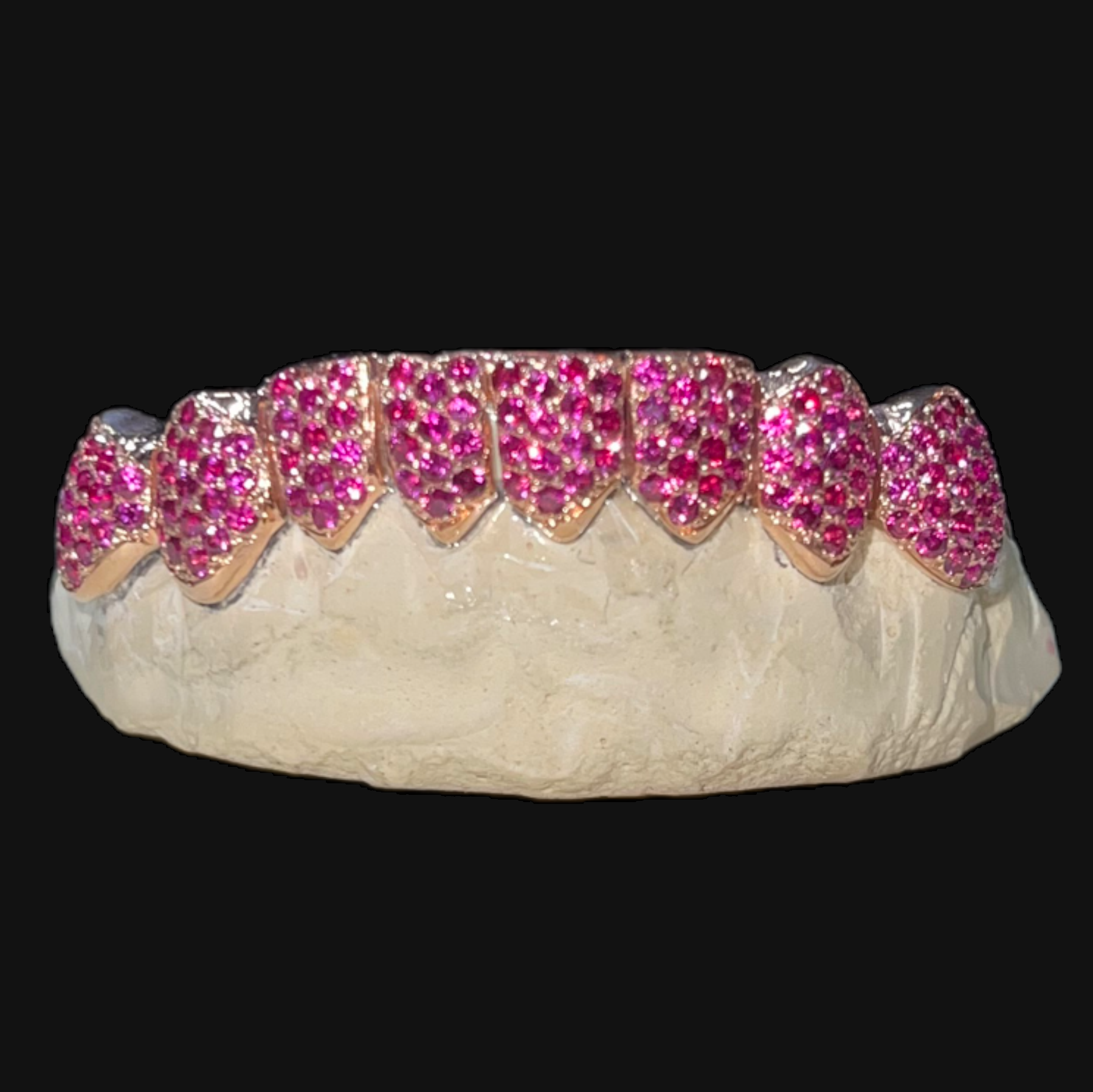 Custom Gemstone Set Grillz - Main Image