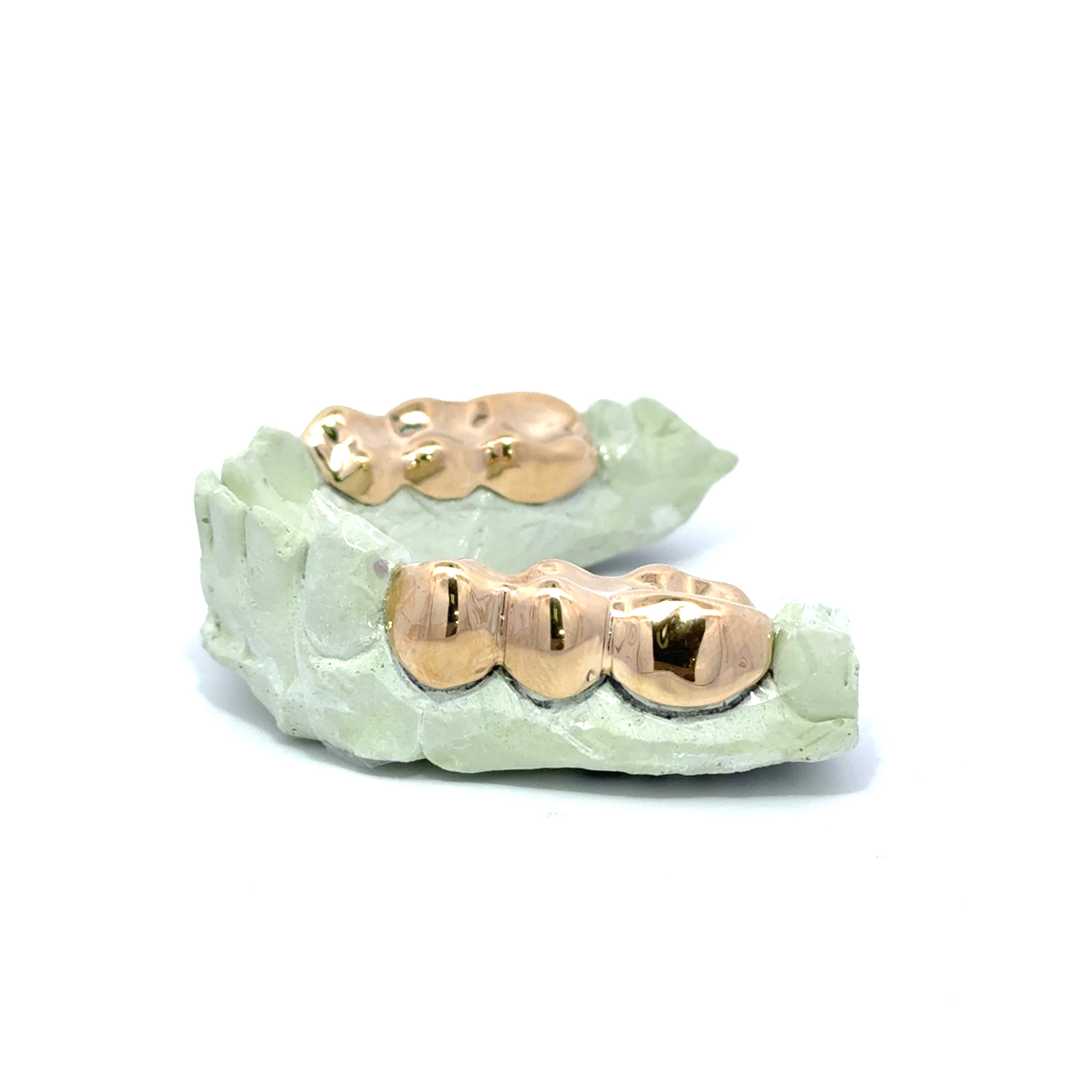 3 Piece Gold Grillz