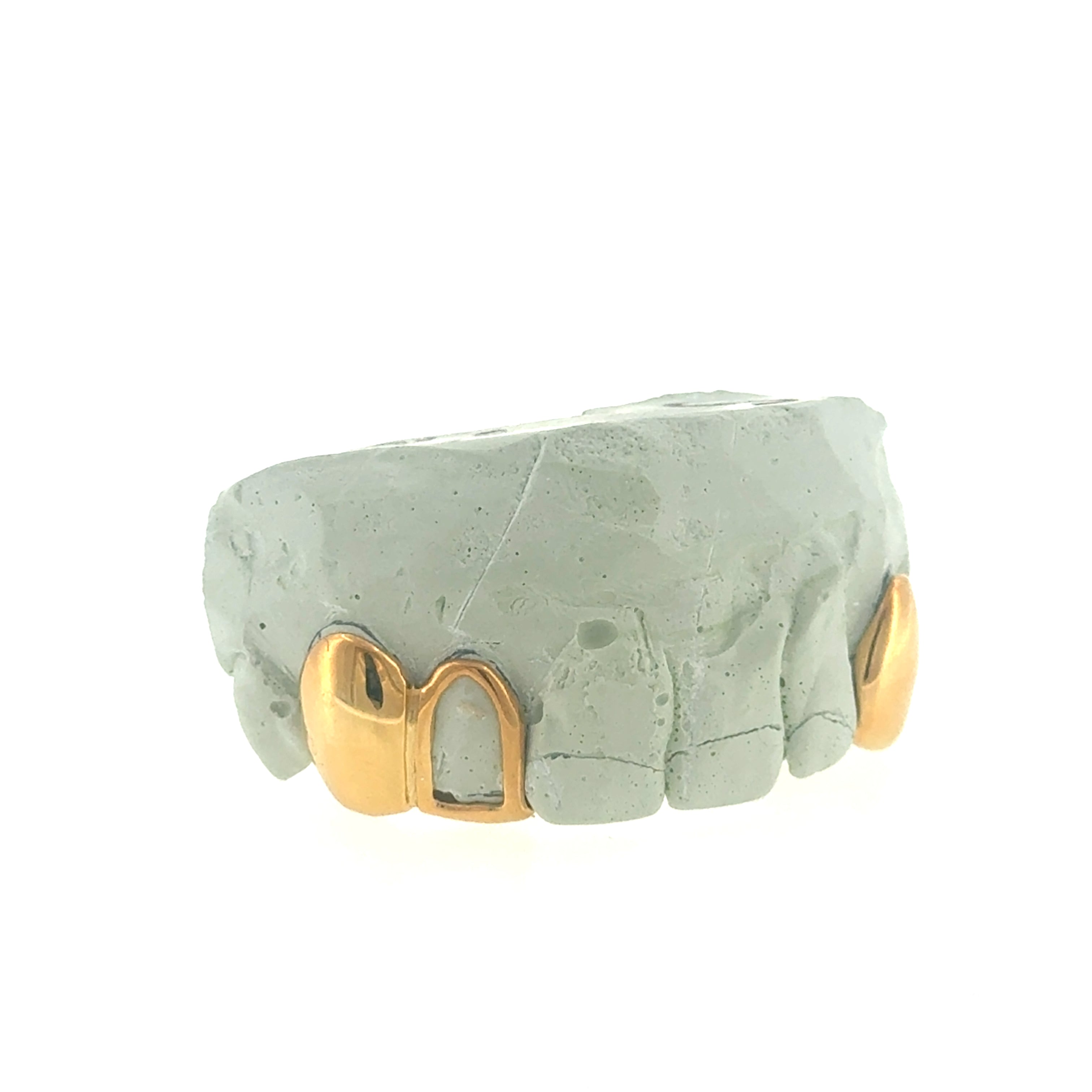 Dub cap + Single with Back Bar