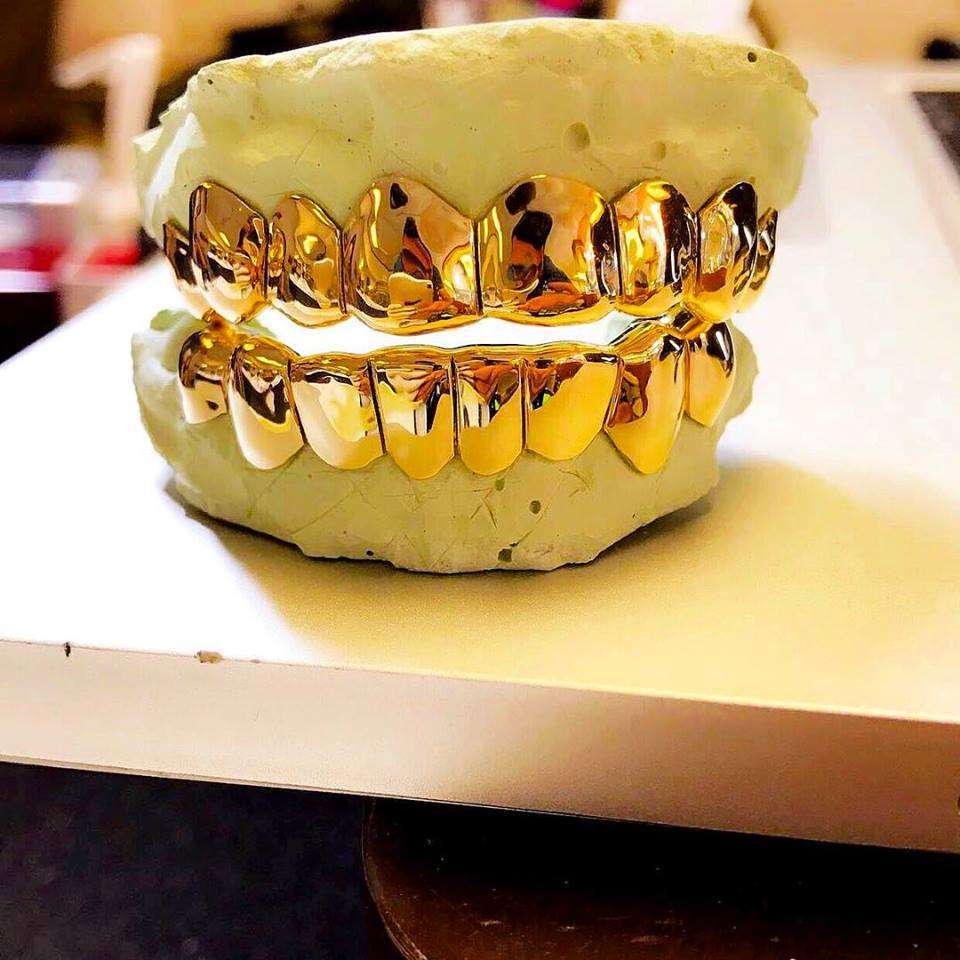 10K Gold Grill Special