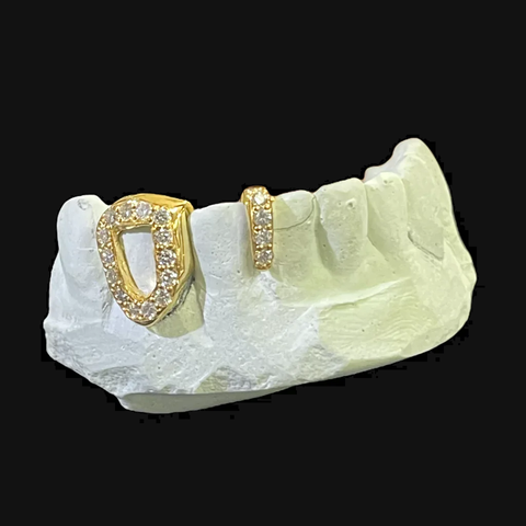 Custom Diamond Spacer Grill