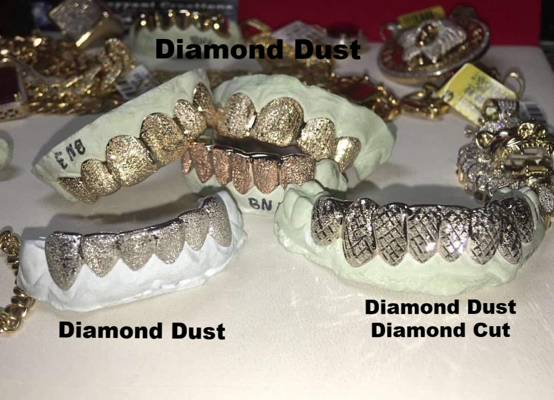 8 top 8 Bottom Custom White, Yellow or Rose Gold Joker Grill from Suicide Squad