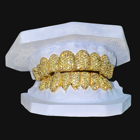 Yellow Canary Diamond Zig Zag Set Grillz